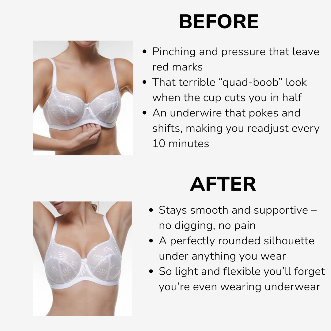 Amberly | Chic French Lingerie Set