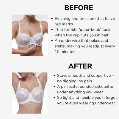 Amberly | Chic French Lingerie Set